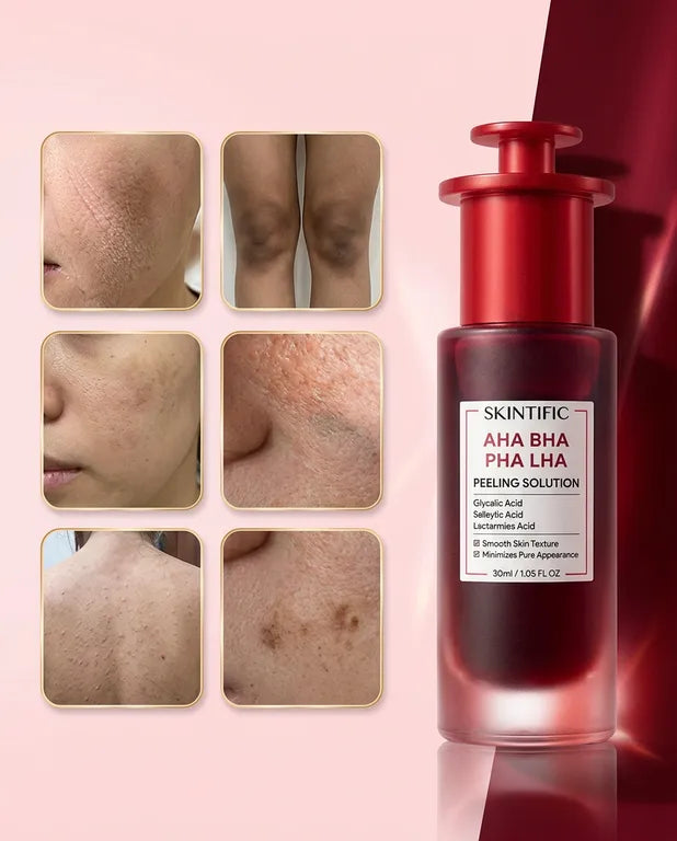 SKINTIFIC – Peeling Nouvelle Peau AHA BHA PHA LHA – 30 ml
